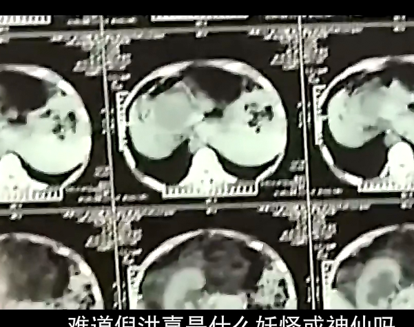 50岁老人每天晨练，去医院检查竟看不到五脏六腑，吓了医生一跳